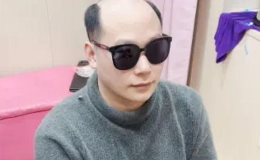 定制假發(fā)的意義在于符合自己的審美、穿搭、年齡